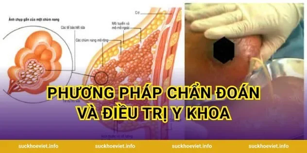 Phương pháp chẩn đoán và điều trị y khoa