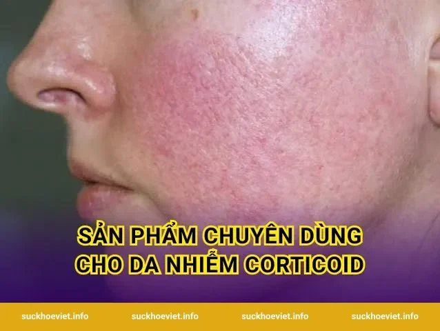 Sản Phẩm Chuyên Dùng Cho Da Nhiễm Corticoid