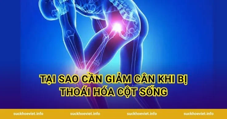 Tại Sao Cần Giảm Cân Khi Bị Thoái Hóa Cột Sống