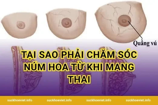 Tại Sao Phải Chăm Sóc Núm Hoa Từ Khi Mang Thai