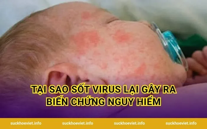 Tại Sao Sốt Virus Lại Gây Ra Biến Chứng Nguy Hiểm