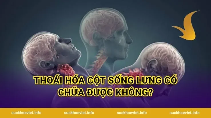 Thoái Hóa Cột Sống Lưng Có Chữa Được Không?