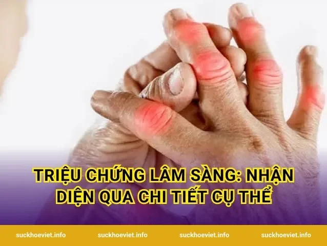 Triệu chứng lâm sàng: Nhận diện qua chi tiết cụ thể