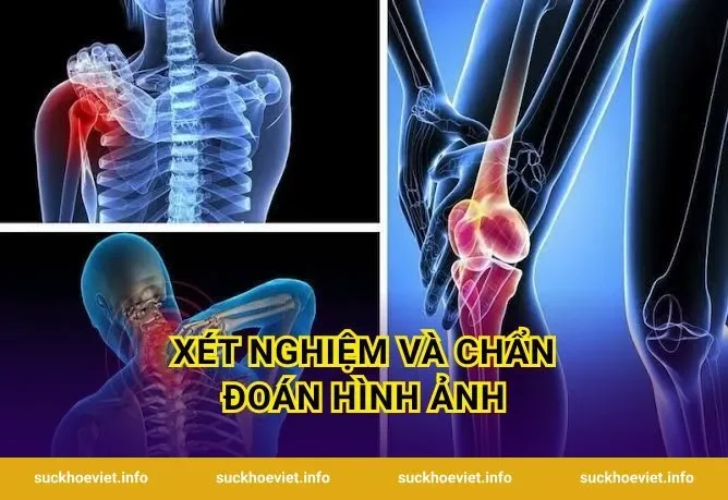 Xét nghiệm và chẩn đoán hình ảnh