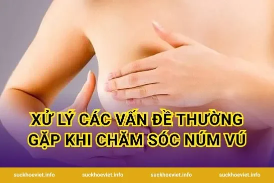 Xử lý các vấn đề thường gặp khi chăm sóc núm vú