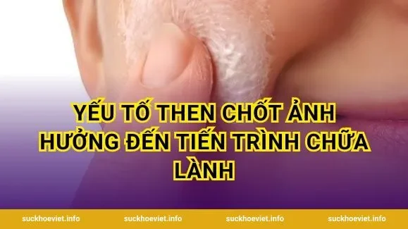 Yếu tố then chốt ảnh hưởng đến tiến trình chữa lành